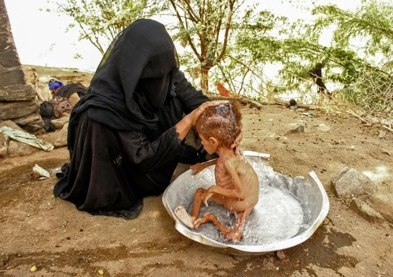 Liên Hợp Quốc kêu gọi thế giới đừng quay lưng với Yemen