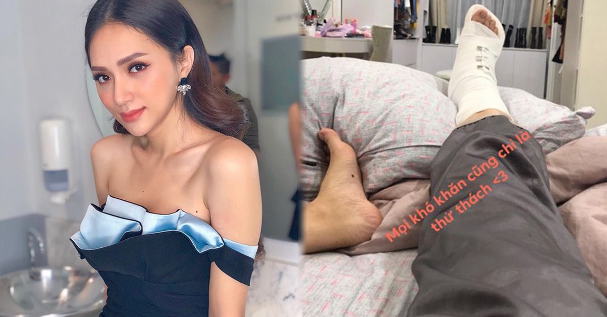 Hoa hậu Hương Giang đăng ảnh bị chấn thương khiến fan đứng ngồi không yên