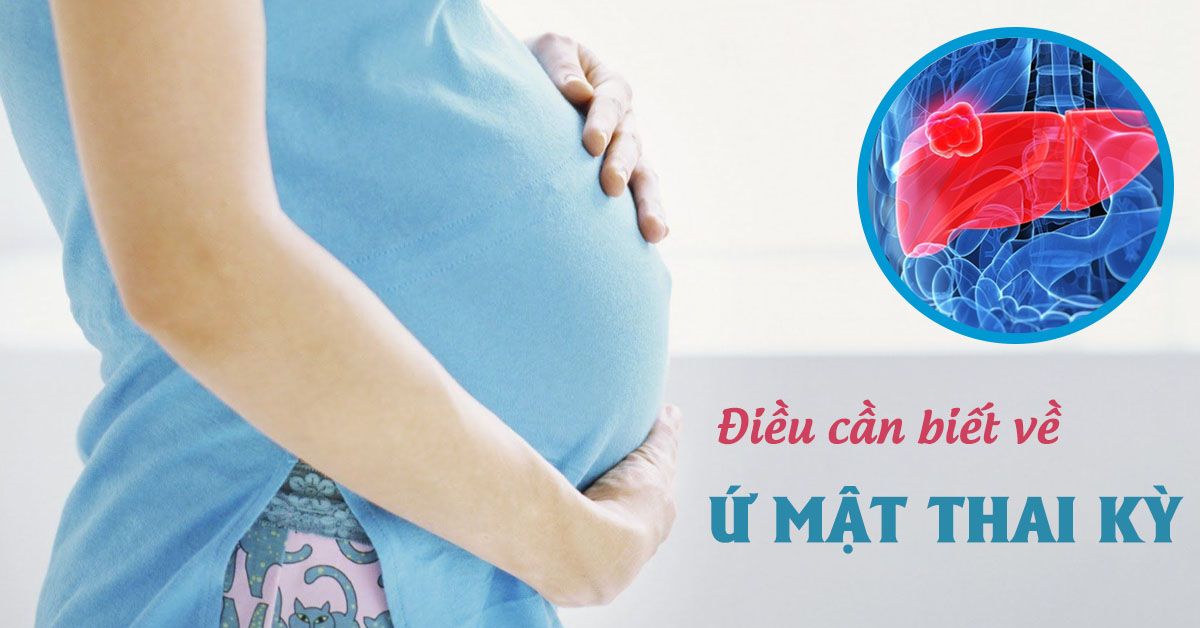 Ứ mật thai kỳ có nguy hiểm không?