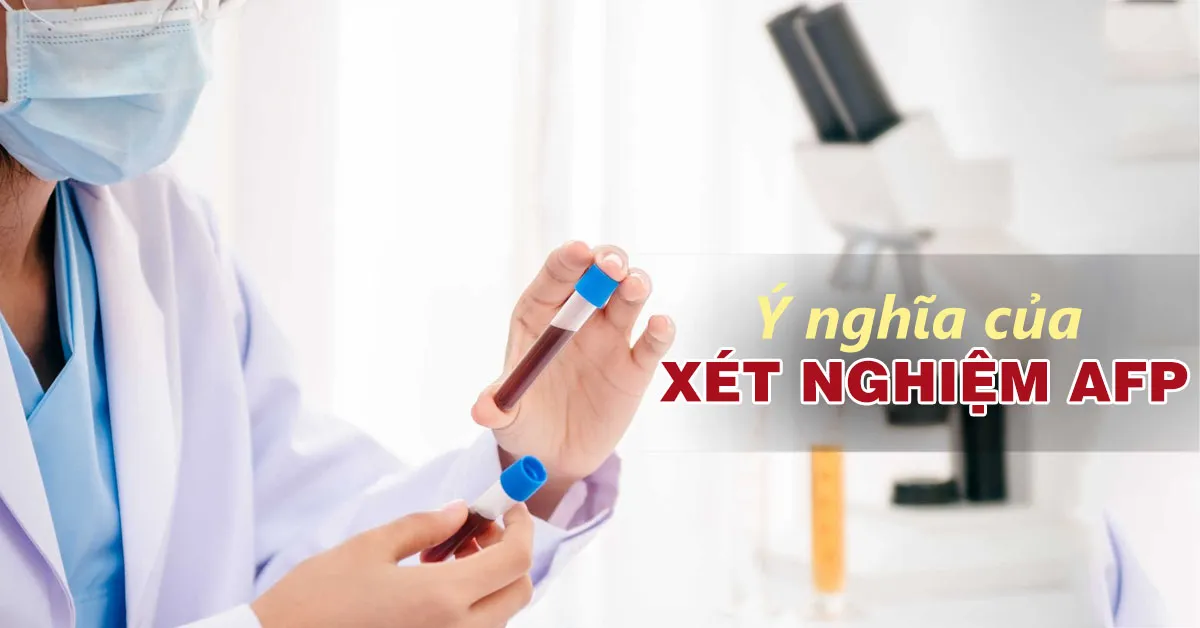 AFP là gì, khi nào cần xét nghiệm AFP để chẩn đoán bệnh?