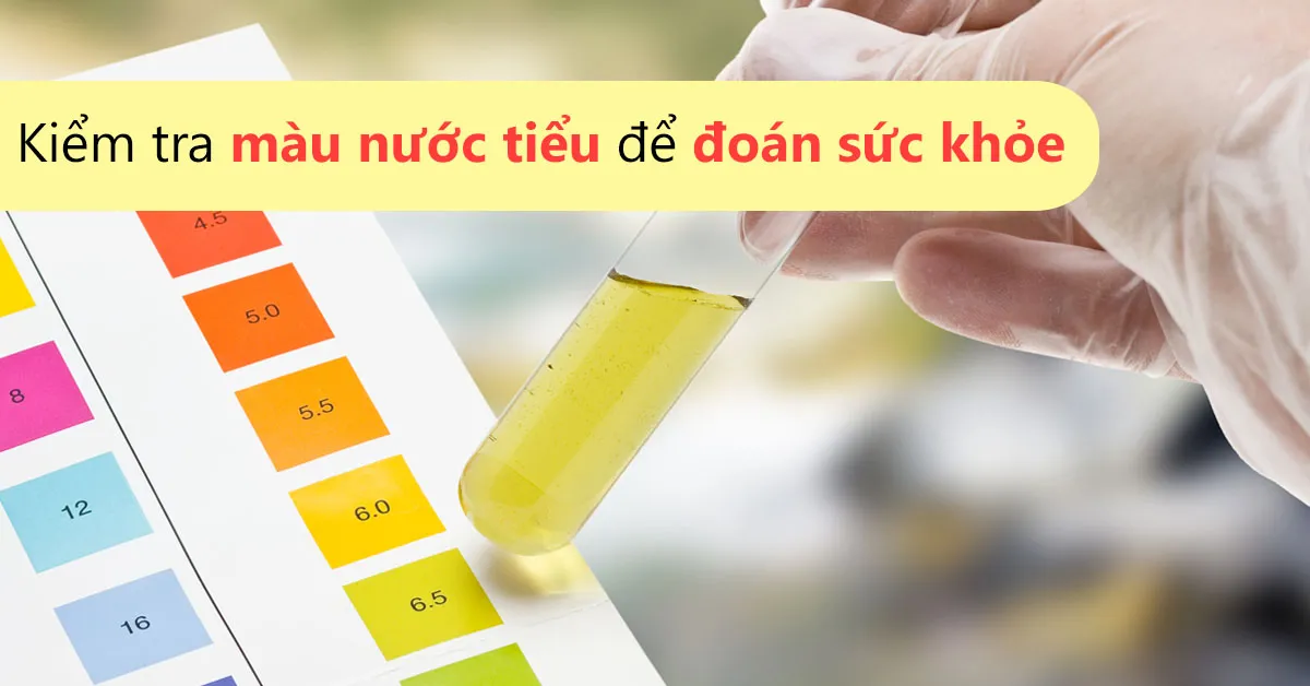 Nước tiểu màu xanh là mắc bệnh gì?