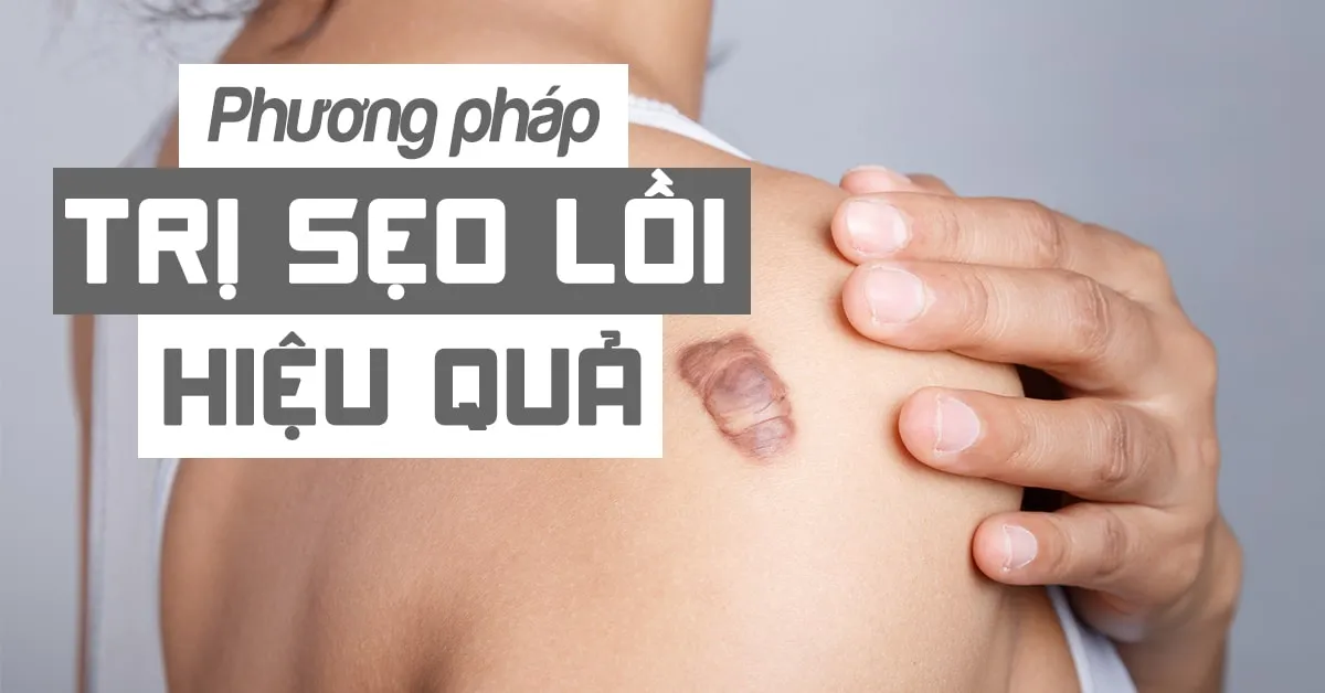 7 phương pháp trị sẹo lồi lâu năm cho hiệu quả tối ưu