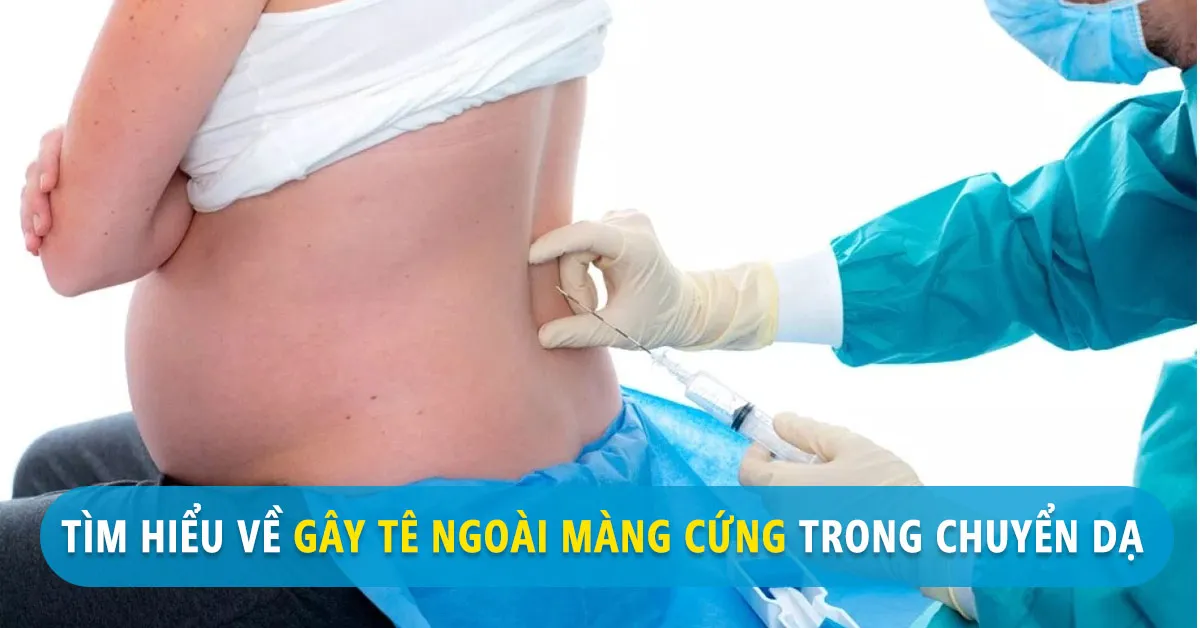 Gây tê ngoài màng cứng – phương pháp giúp bà bầu đẻ không đau