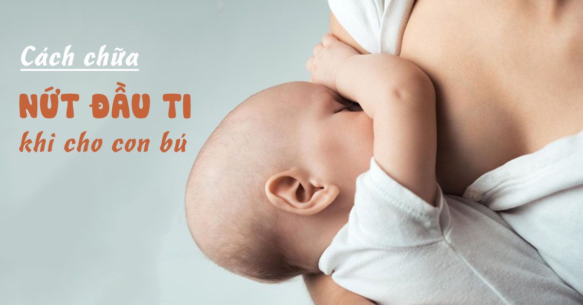 Nguyên nhân khiến mẹ bị ‘nứt cổ gà’ và cách chữa trị