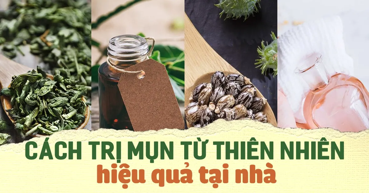 4 cách trị mụn từ thiên nhiên an toàn và hiệu quả tại nhà