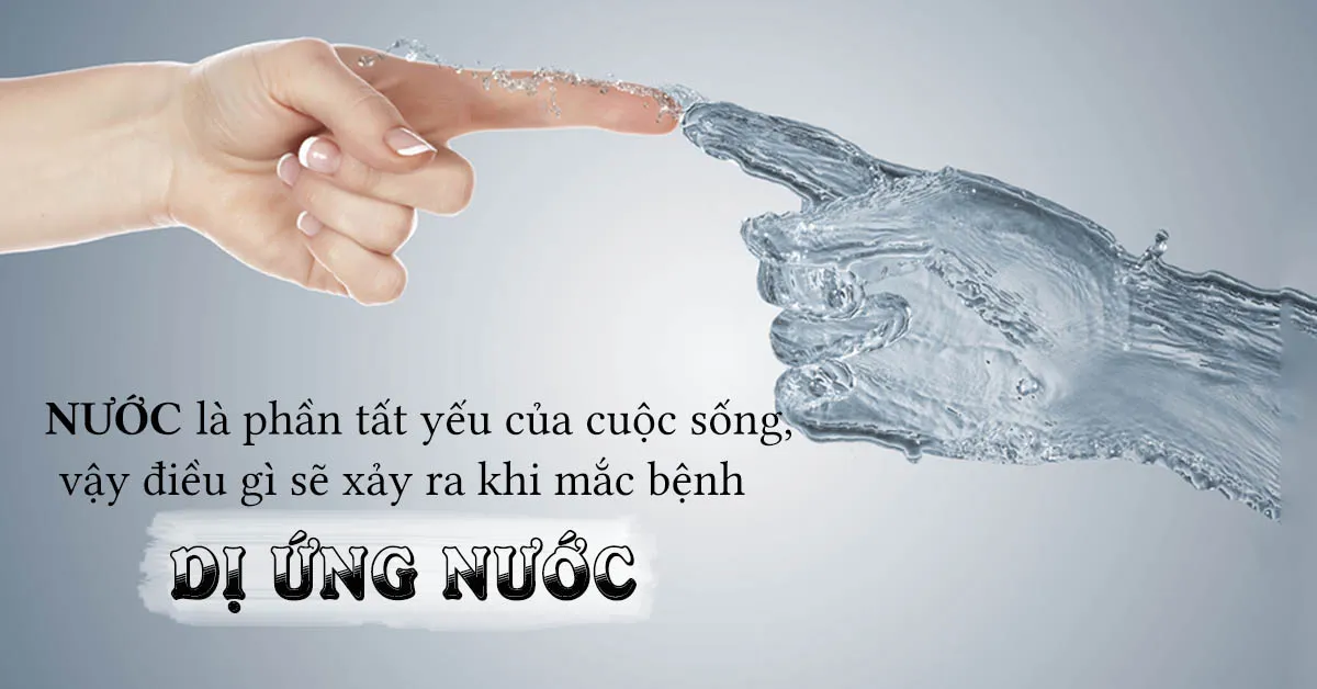 Dị ứng nước là bệnh gì, có dễ mắc phải không?