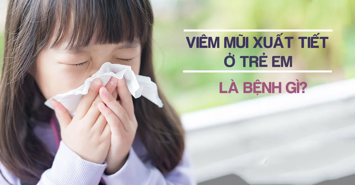 Viêm mũi xuất tiết ở trẻ em là bệnh gì? Có nguy hiểm không?