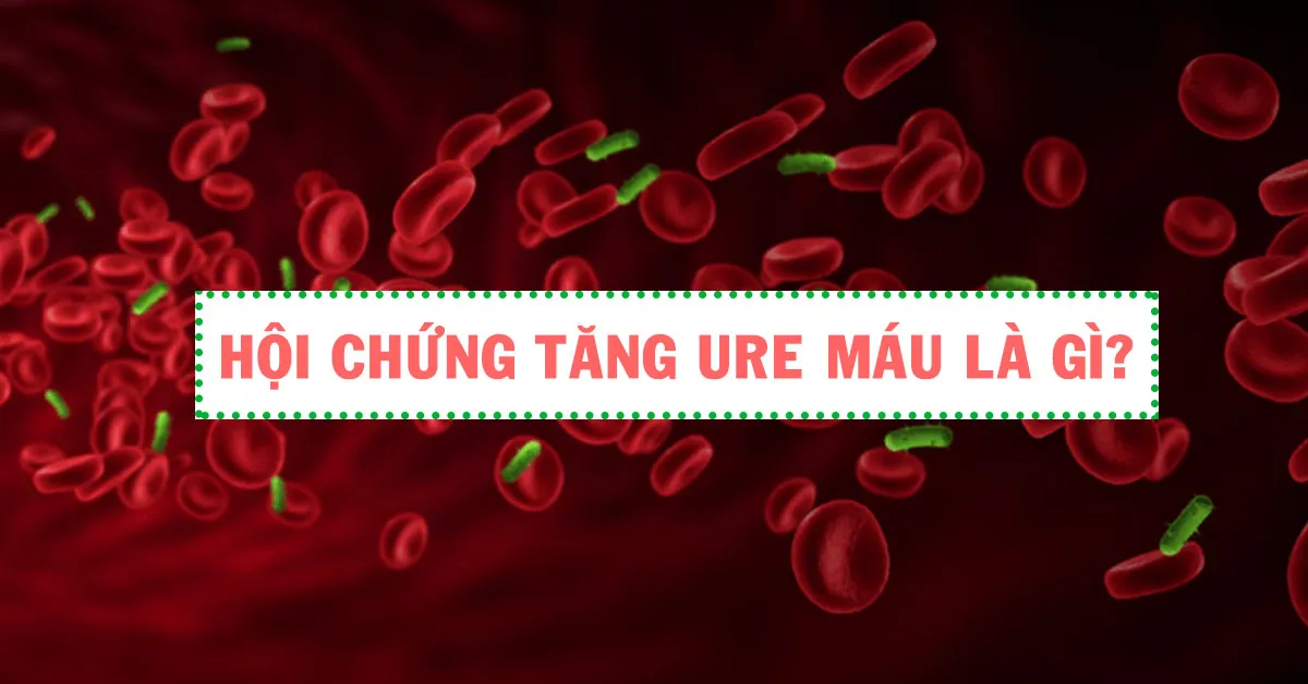 Tìm hiểu cụ thể về hội chứng tăng ure máu