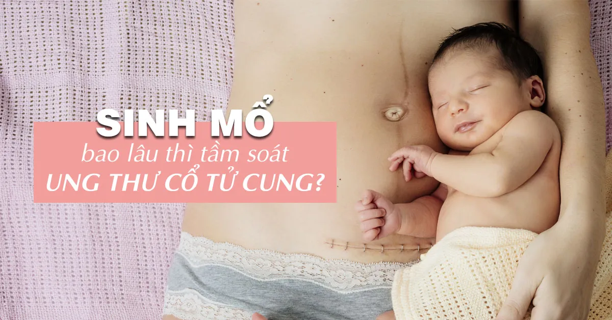 Sinh mổ bao lâu thì lành, bao lâu thì tầm soát ung thư cổ tử cung?