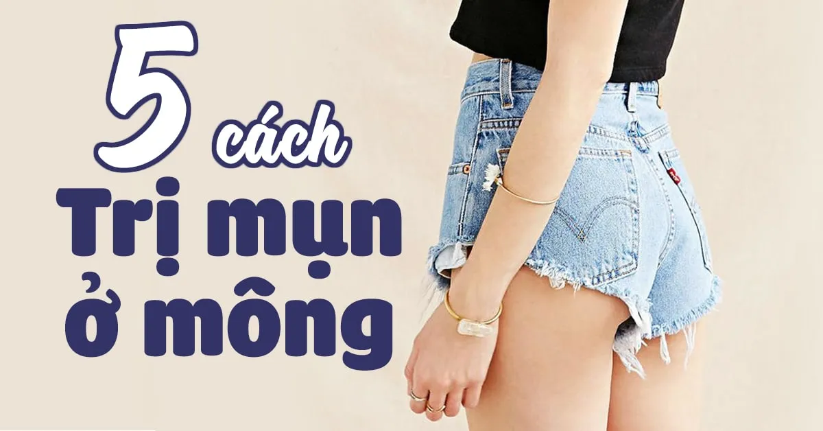 Mách bạn cách trị mụn ở mông nhanh chóng và không để lại sẹo