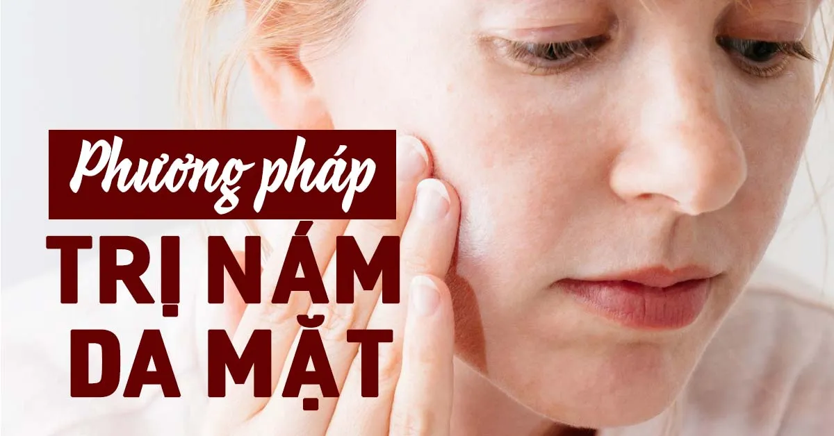 Những phương pháp trị nám da mặt giúp bạn sở hữu làn da ‘không tì vết’