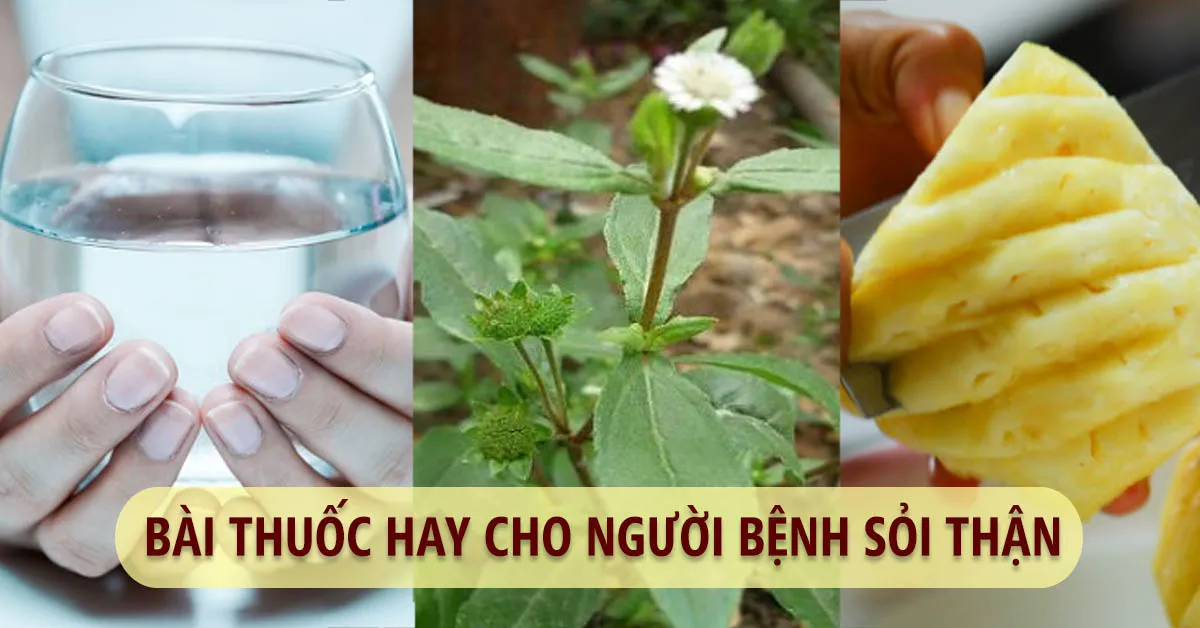 Cách chữa bệnh sỏi thận tại nhà bằng các bài thuốc dân gian