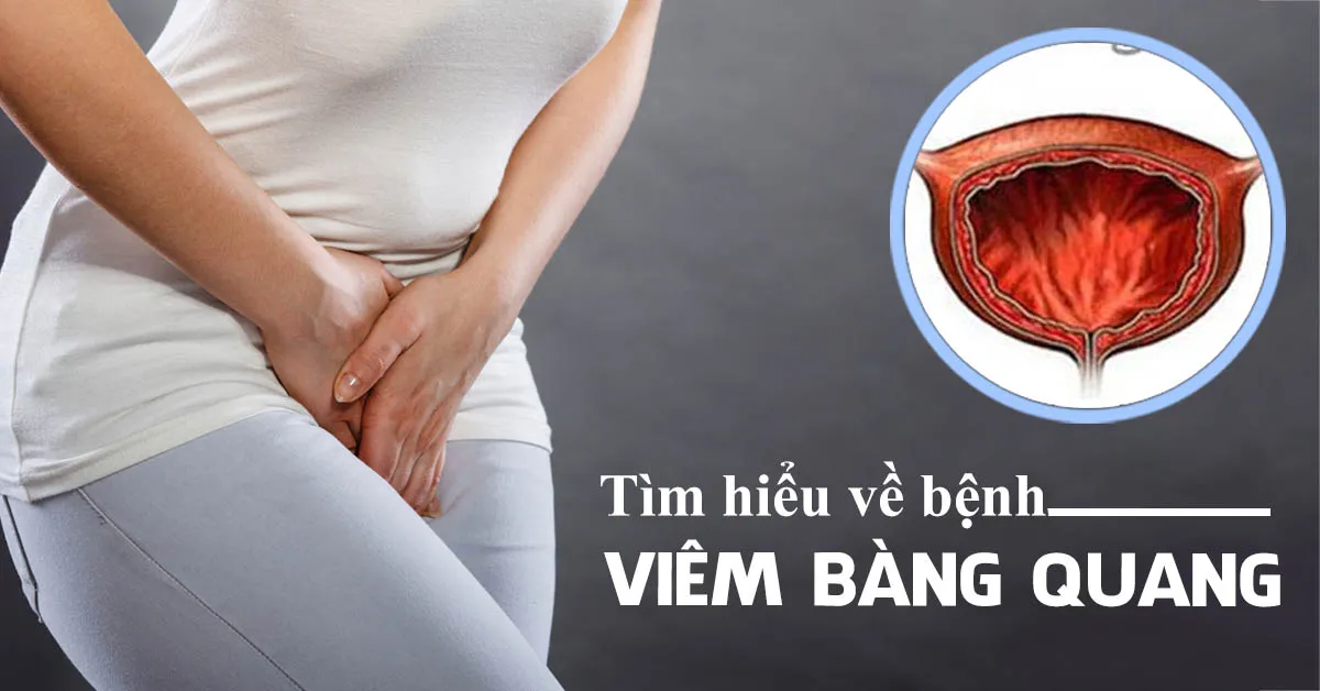 Viêm bàng quang – nguyên nhân và các dấu hiệu nhận biết