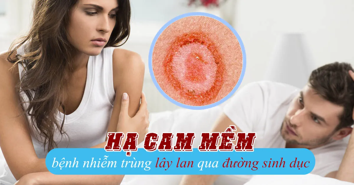 Bệnh hạ cam và những kiến thức cần biết