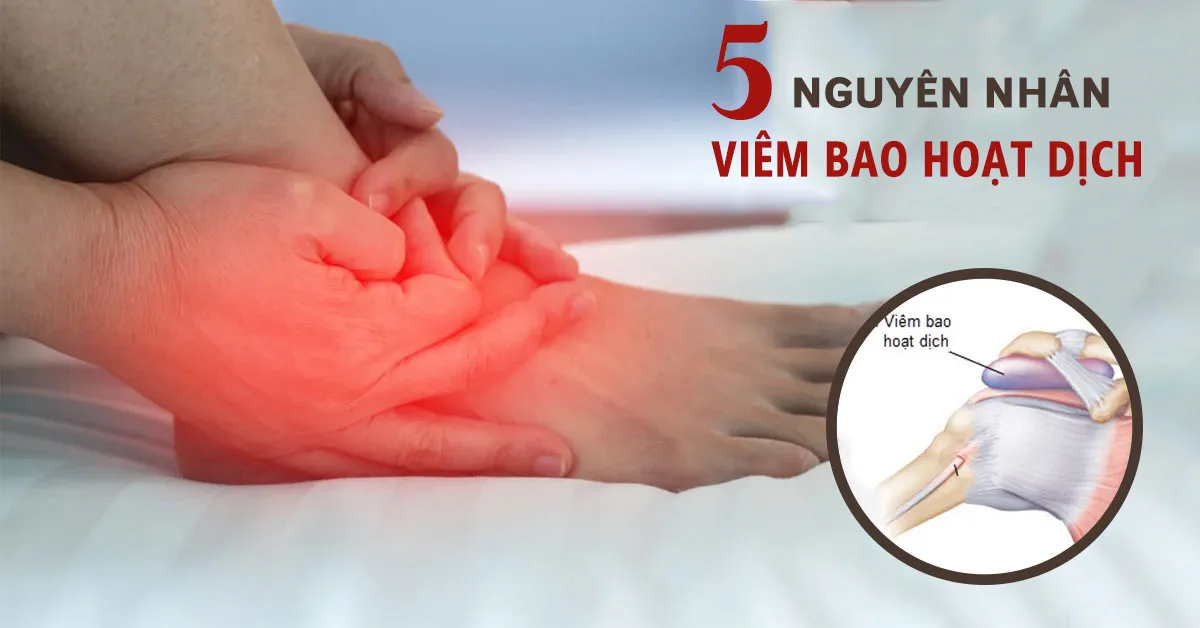 Viêm bao hoạt dịch là bệnh gì? Đối tượng nào dễ mắc phải?