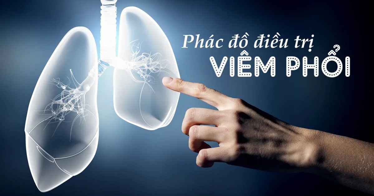 Tìm hiểu phác đồ điều trị viêm phổi