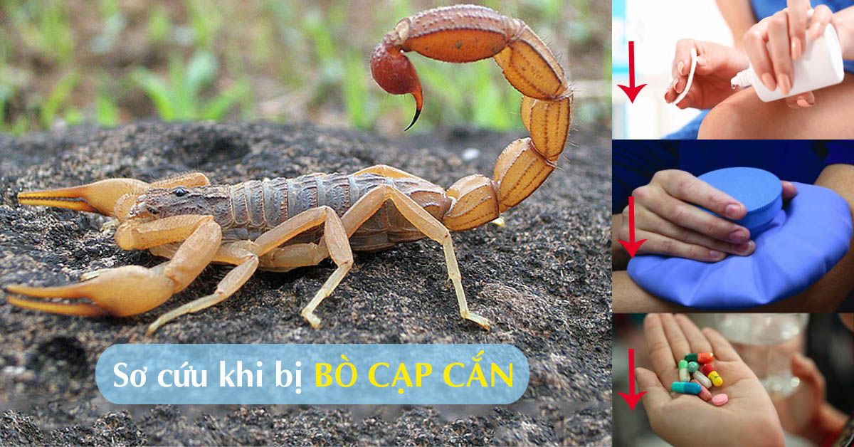 Bò cạp cắn phải làm sao?