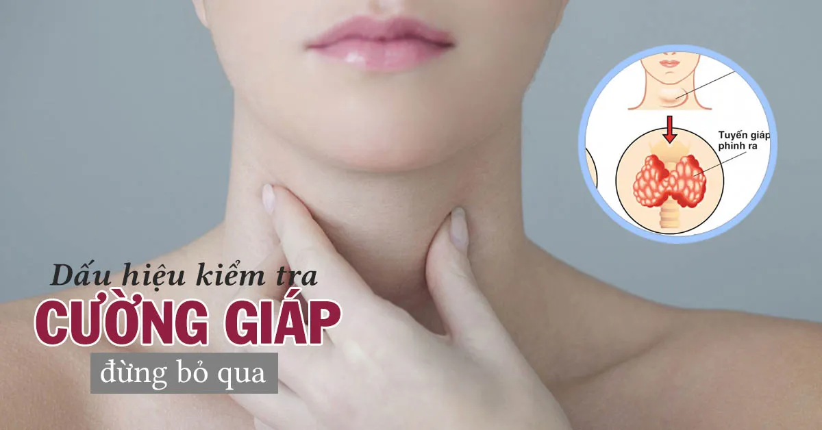 Cường giáp là gì, có nguy hiểm không?