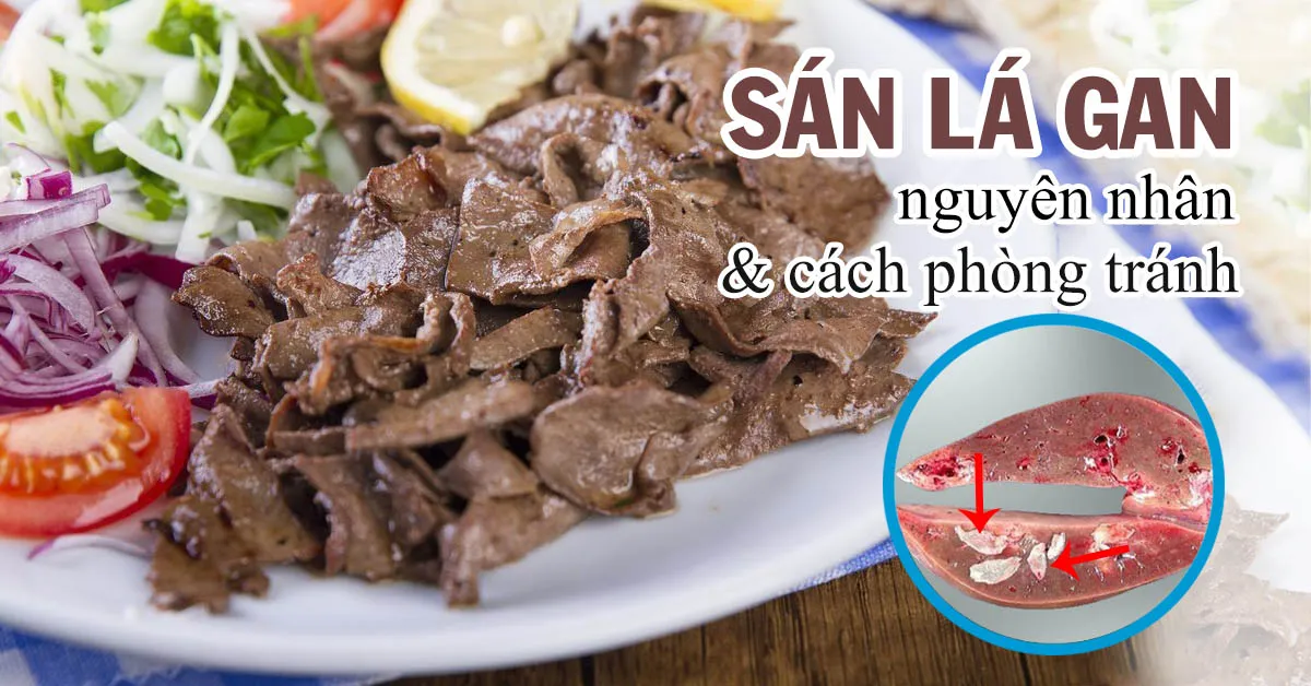Sán lá gan là gì, nguy hiểm như thế nào?
