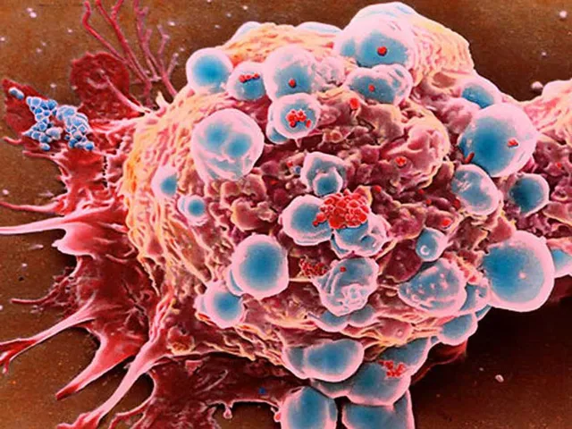 Ung thư vượt bệnh tim mạch, trở thành nguyên nhân tử vong hàng đầu tại các nước giàu