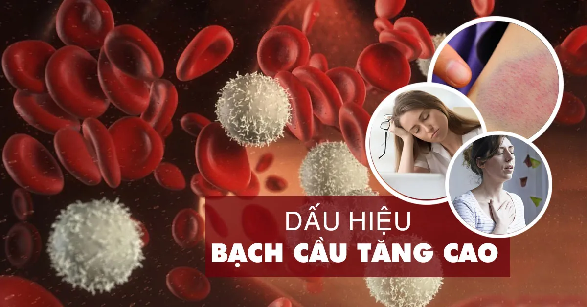 Bạch cầu tăng cao là bao nhiêu, có nguy hiểm không?