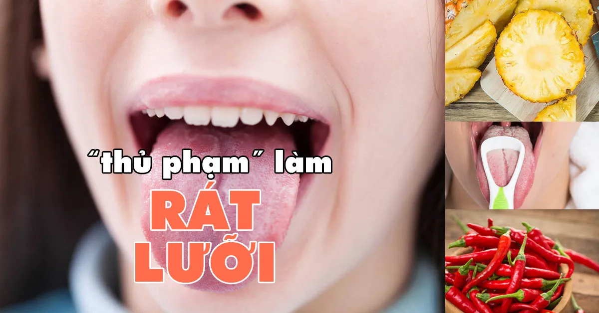 Lý giải nguyên nhân gây rát lưỡi