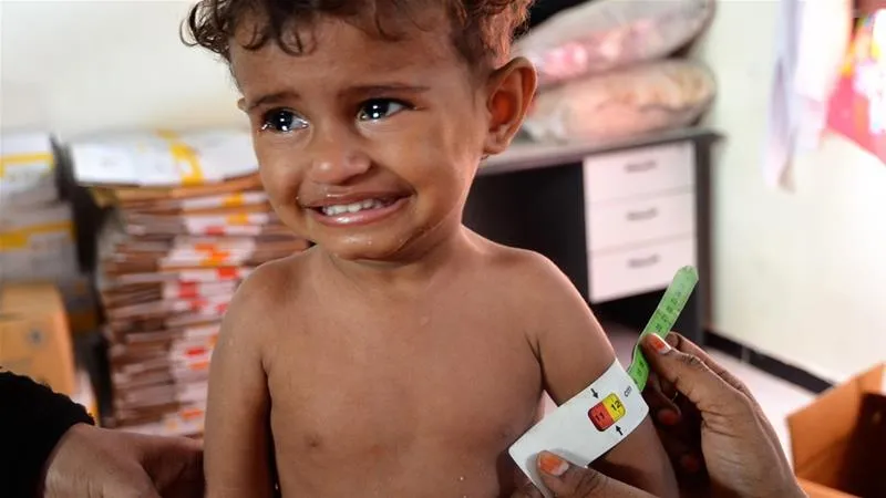 Liên Hợp Quốc mở chiến dịch tiêm chủng bệnh bạch hầu cho trẻ em Yemen