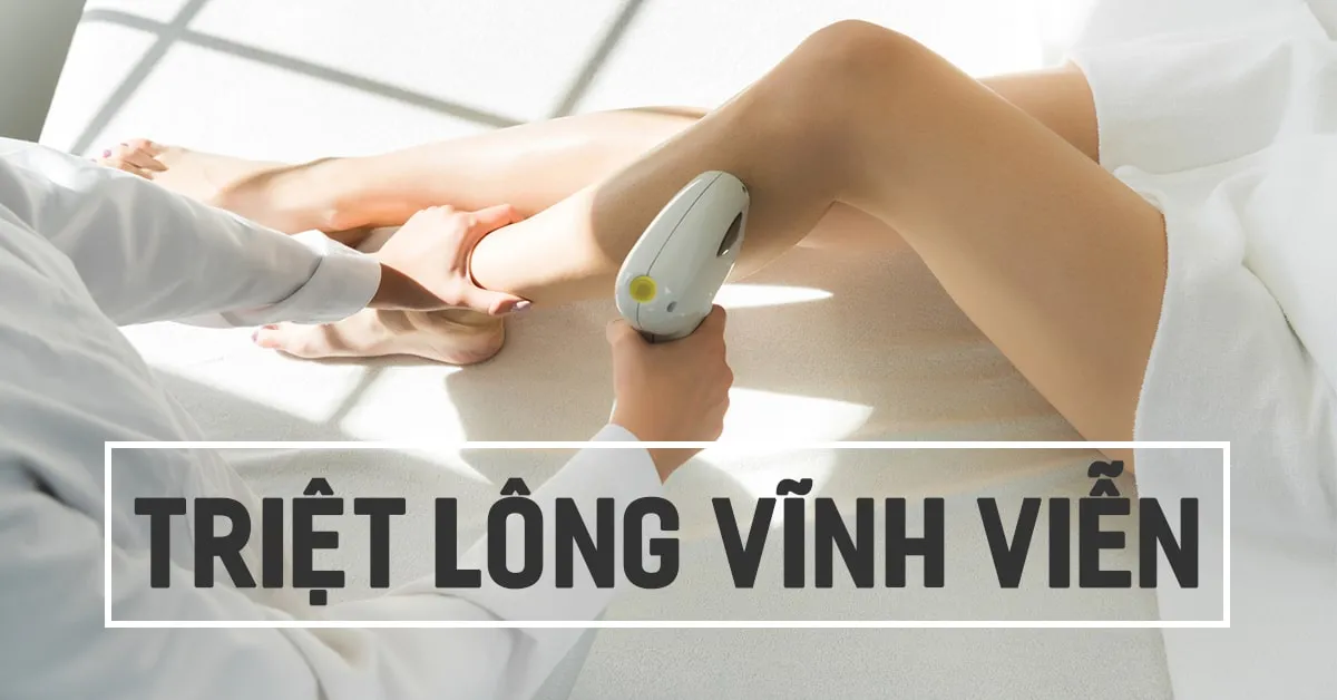 3 phương pháp triệt lông vĩnh viễn được ưa chuộng nhất hiện nay