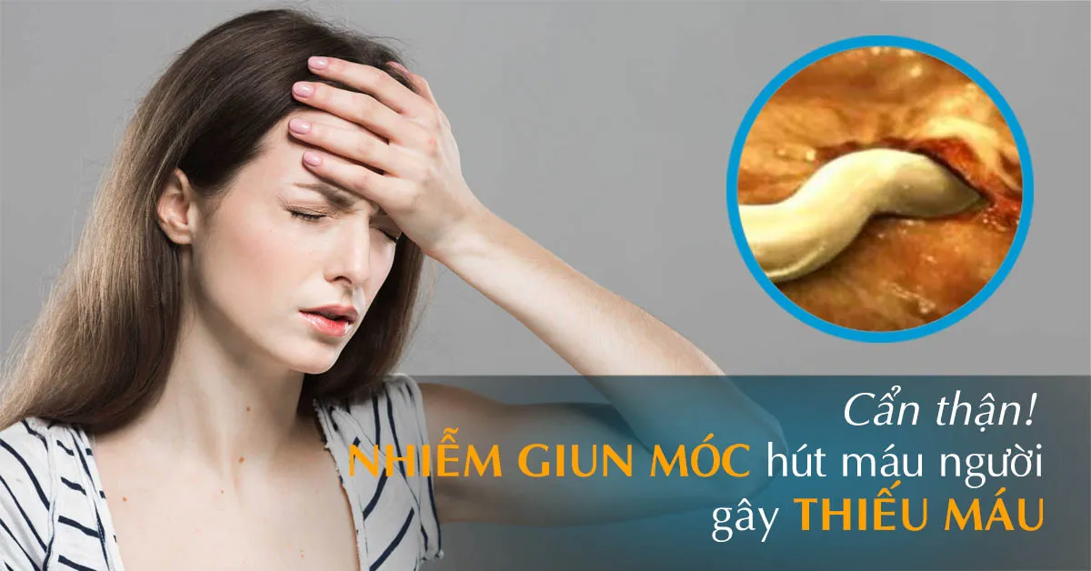 Giun móc – Dấu hiệu bị lây nhiễm và cách điều trị