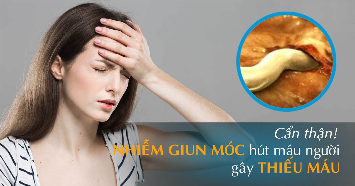 Giun móc – Dấu hiệu bị lây nhiễm và cách điều trị