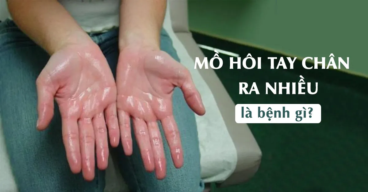 Nguyên nhân và cách khắc phục chứng ra mồ hôi tay chân