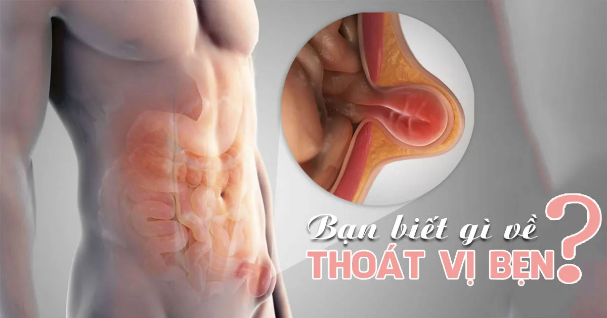Thoát vị bẹn là bệnh gì, điều trị như thế nào?