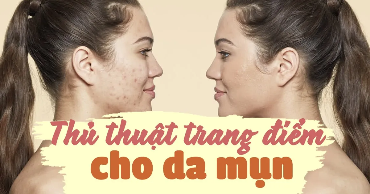 7 thủ thuật trang điểm dành cho da mụn