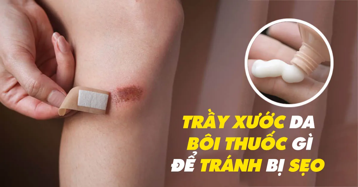 THỜI GIAN LÀNH VẾT TRẦY XƯỚC DA TÙY THUỘC VÀO MỨC ĐỘ TỔN THƯƠNG