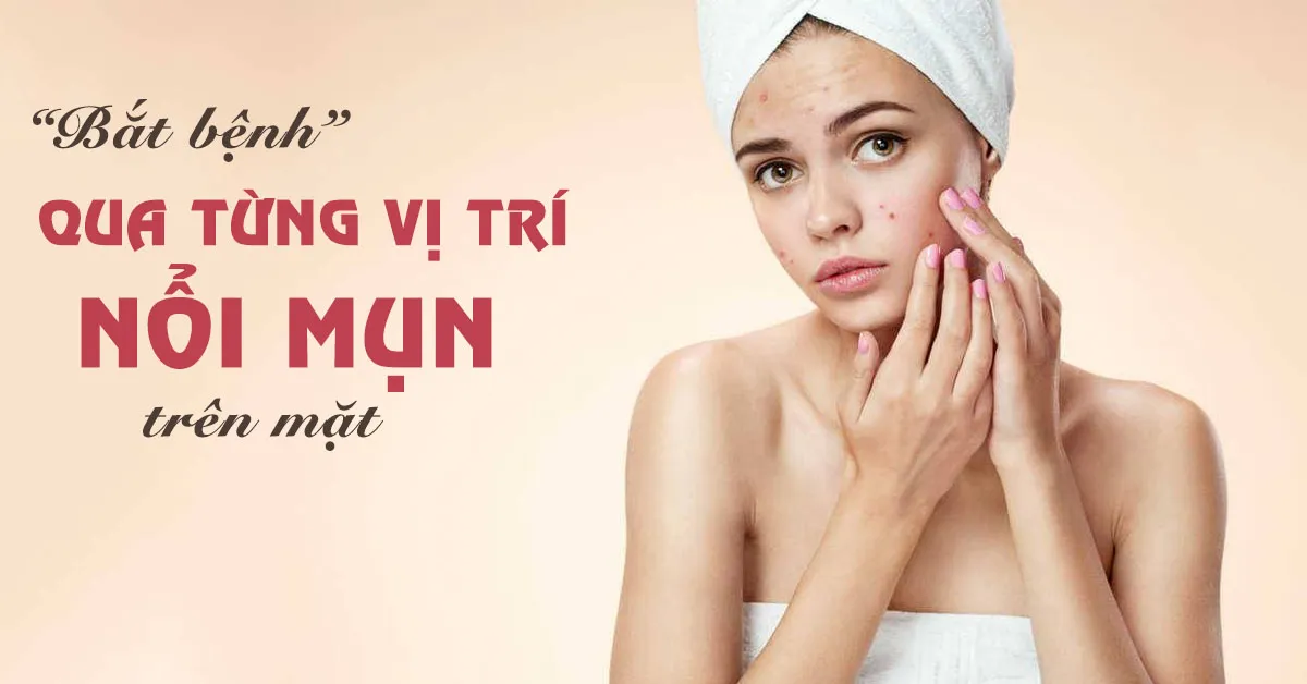 ‘Đoán bệnh’ qua 9 vị trí nổi mụn trên mặt