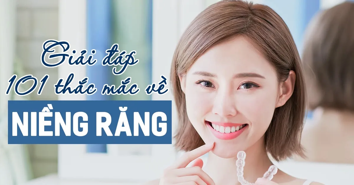 Niềng răng: phương pháp chỉnh nha đem lại nụ cười đẹp tự nhiên