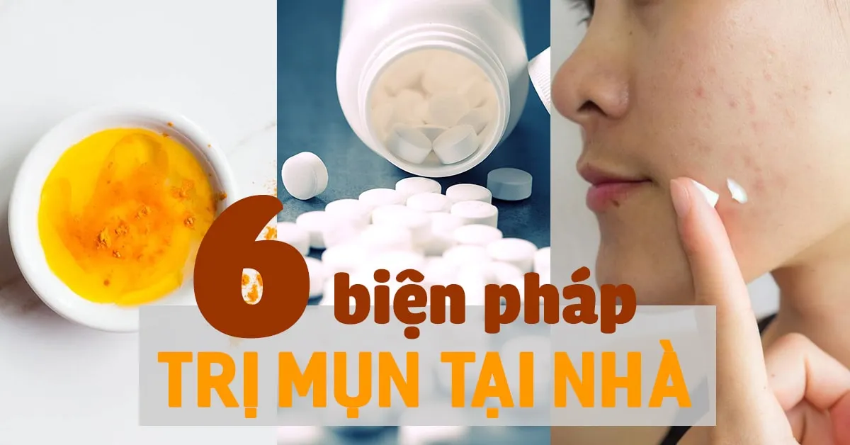 6 cách trị mụn tại nhà giúp da nhẵn mịn, dứt điểm với mụn