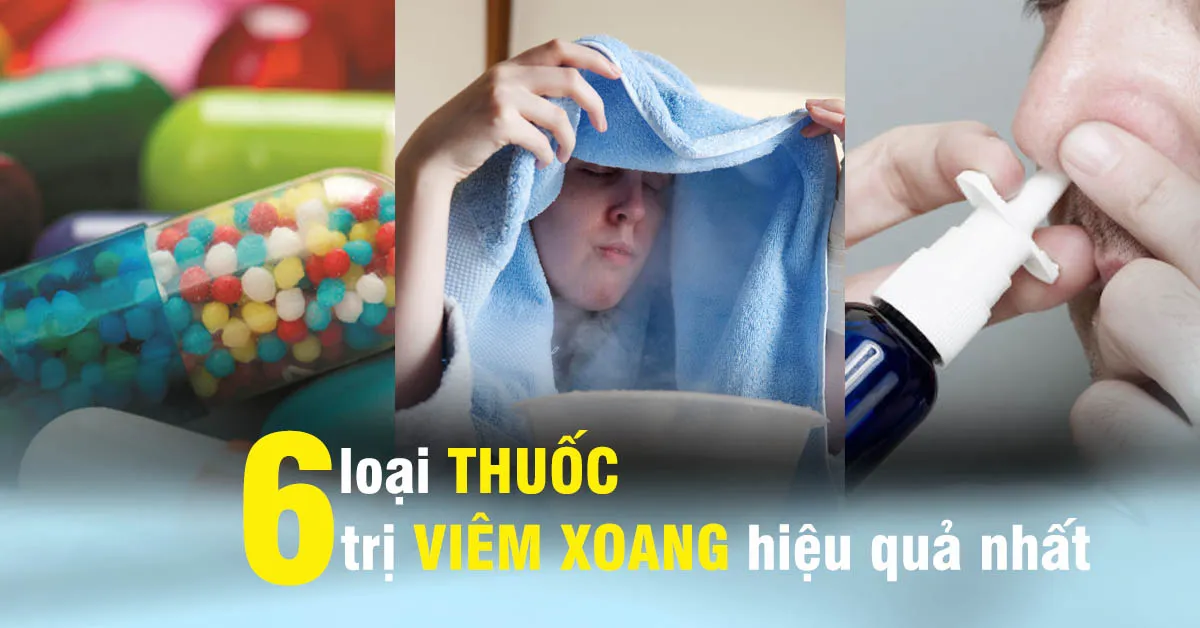 Tìm hiểu các loại thuốc trị viêm xoang hiệu quả nhất