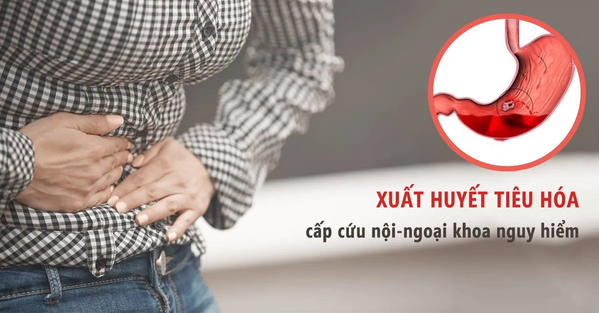 Xuất huyết tiêu hóa có nguy hiểm không, làm sao nhận biết?