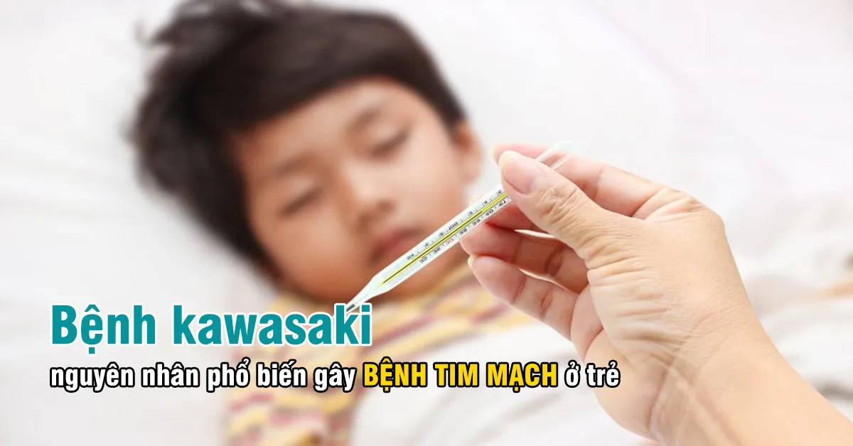 Bệnh kawasaki ở trẻ em là bệnh gì?