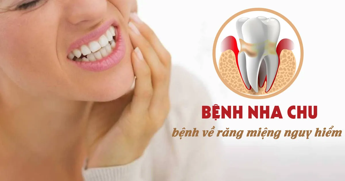 Tìm hiểu về bệnh nha chu và phương pháp điều trị