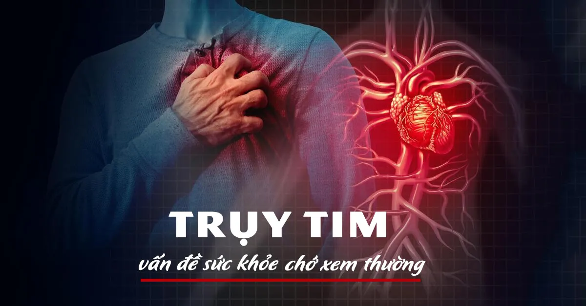 Trụy tim: Triệu chứng nhận biết và phương pháp điều trị