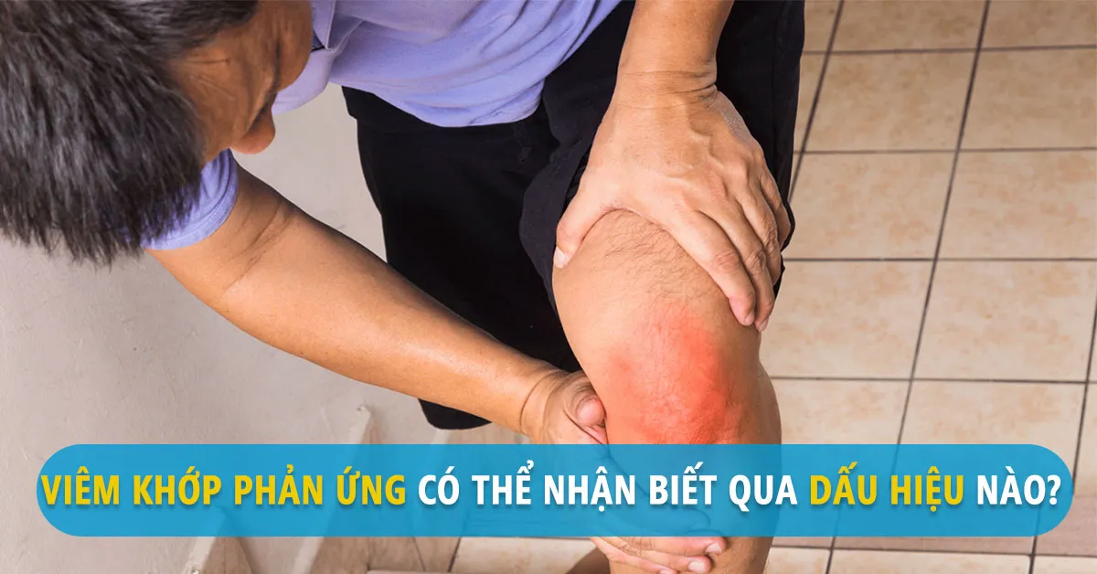 Viêm khớp phản ứng là bệnh gì, làm sao nhận biết?