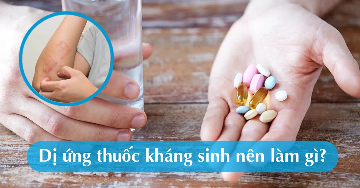 Dị ứng kháng sinh phải làm sao?