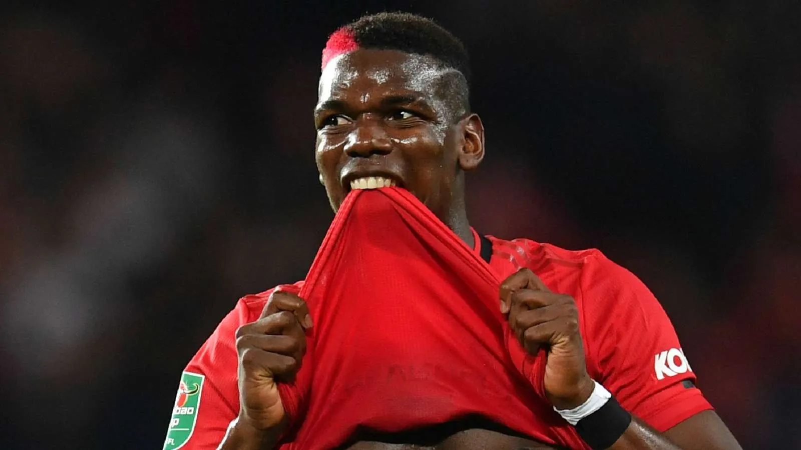 Pogba chấn thương, khả năng lỡ đại chiến Arsenal