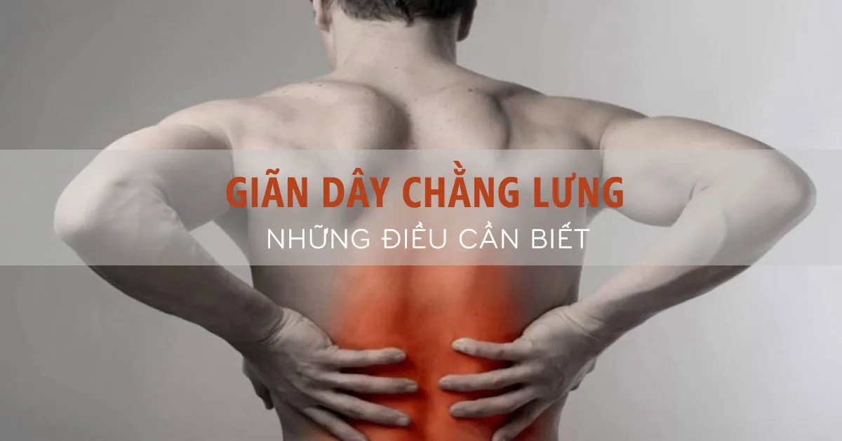 Nguyên nhân gây giãn dây chằng lưng và cách khắc phục