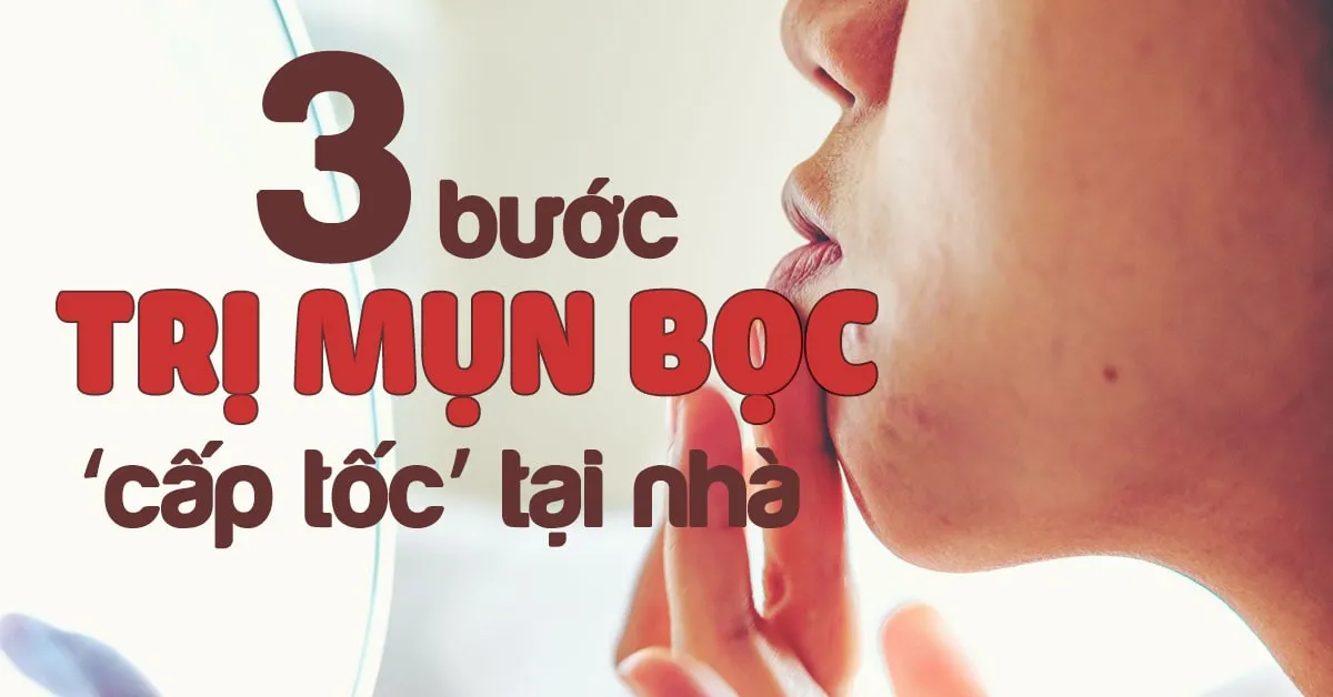 3 bước trị mụn bọc sưng đỏ nhanh chóng và hiệu quả ngay tại nhà