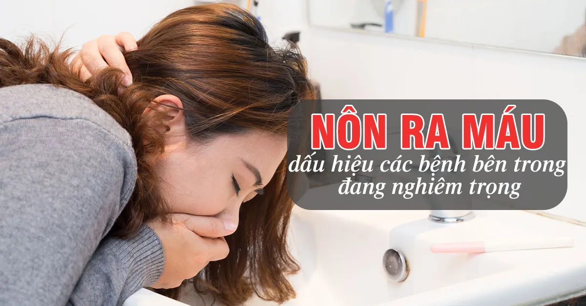 Nôn ra máu – dấu hiệu của bệnh gì?