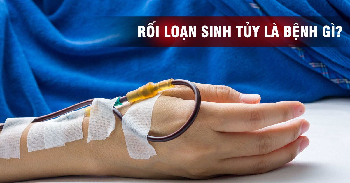 Bệnh rối loạn sinh tủy: Dấu hiệu nhận biết và cách điều trị