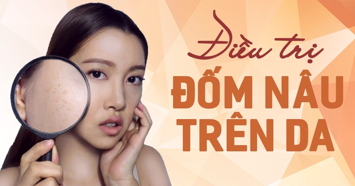 Xuất hiện đốm nâu trên da: nguyên nhân, cách điều trị và phòng ngừa